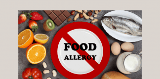 different foods with a "FOOD ALLERGY" sign crossed out in center