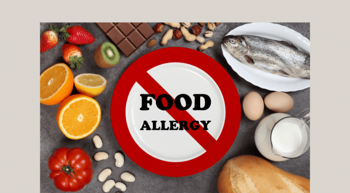 different foods with a "FOOD ALLERGY" sign crossed out in center