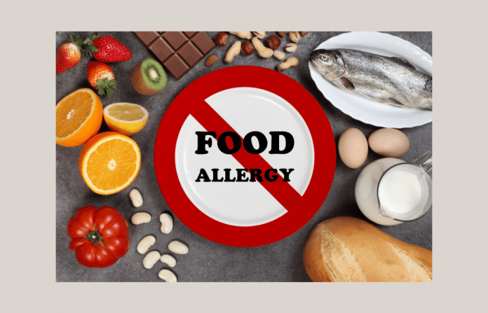 different foods with a "FOOD ALLERGY" sign crossed out in center